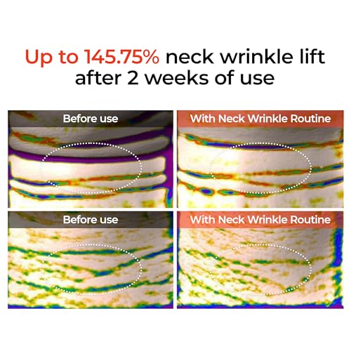 Dr.Mealxin Perfect Neck Wrinkle Care Set Necksphalt Cream+Ampoule+Necklinephalt neck wrinles skin volume lifting