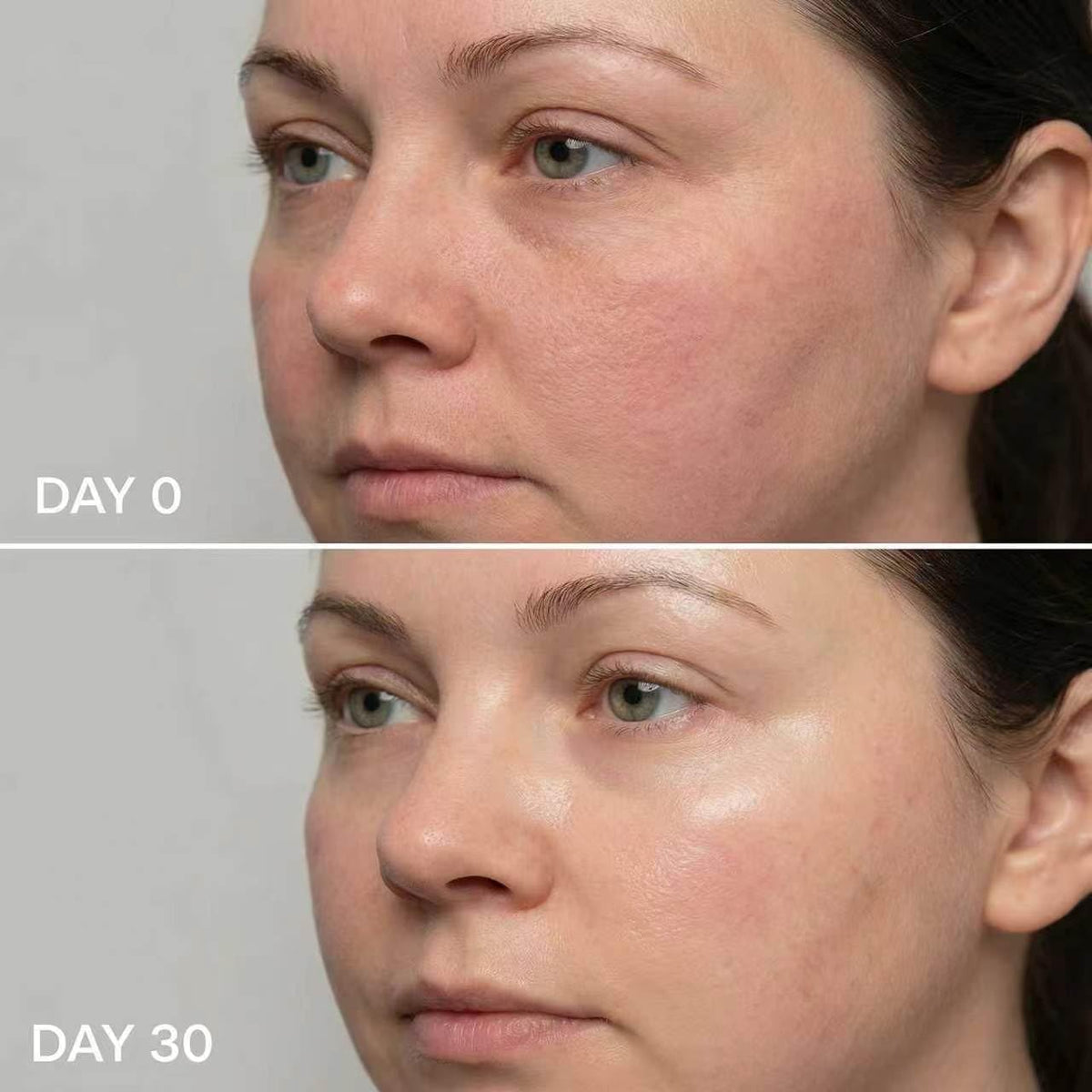 Micro Infusion System for Face & Neck-Micro Infusion Kit to Leave Skin Firmer & Smoother-0.25mm Facial Stamp with Collagen & Hyaluronic Acid Serum for At Home Glow and Anti-aging-3 Month Supply