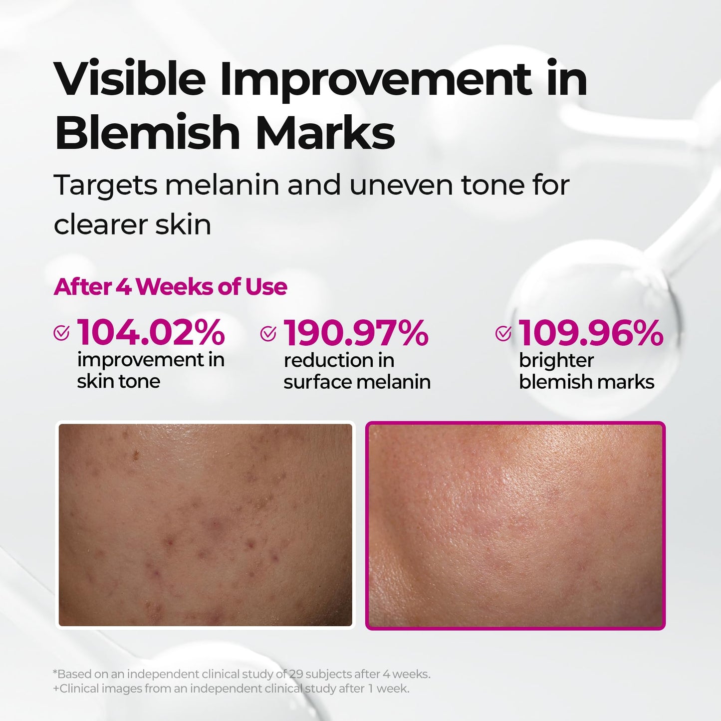 Dr.Melaxin Cyano Pink Spicule Serum with Vitamin B12, Liquid Microneedle Facial Treatment for Enlarged Pores, Niacinamide for Texture Refining & Renewal, 1.01 fl.oz
