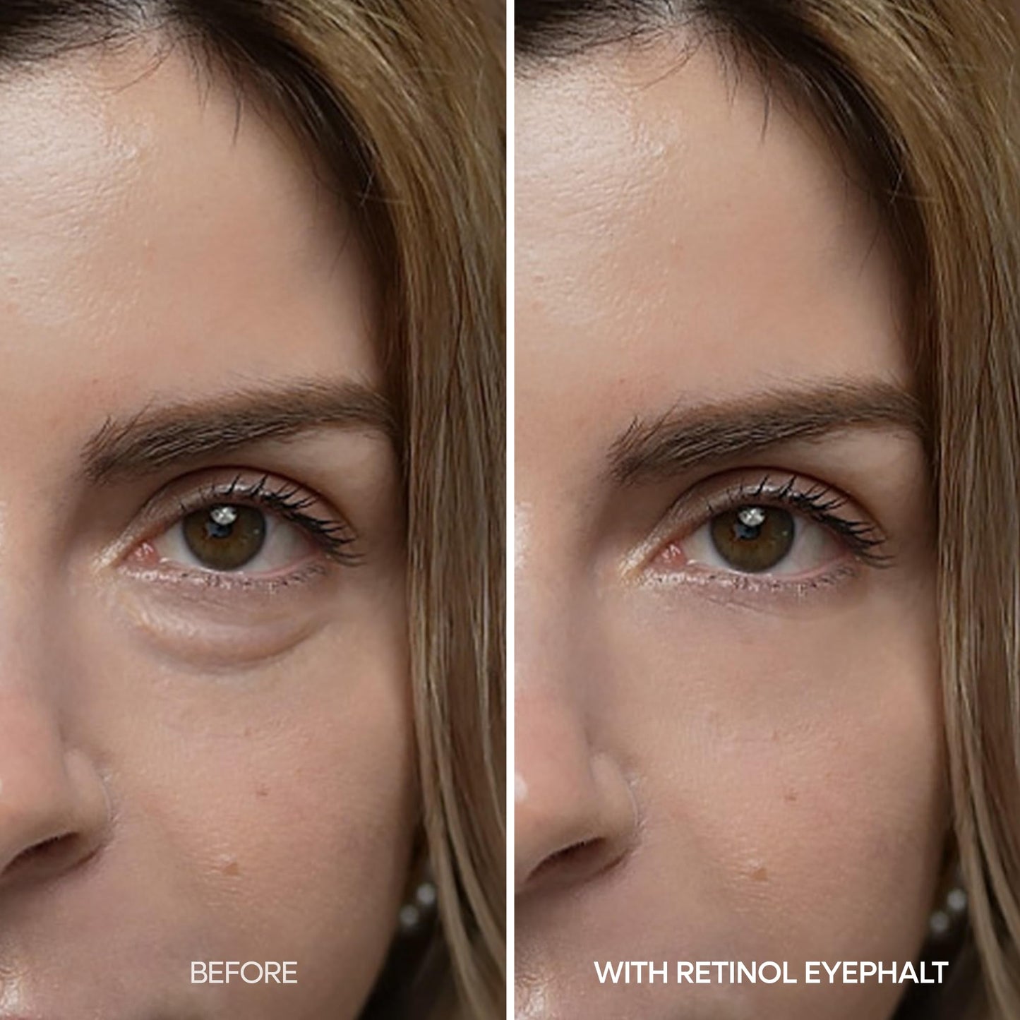 Dr.Melaxin Eyephalt Under Eye Cream for Dark Circles and Puffiness, Eye Cream for Bags Under Eyes with Bio-Spicule, EGF & Niacinamide, Depuffing Eye Bag Lifting Treatment, Korean Skin Care, 0.33 fl oz