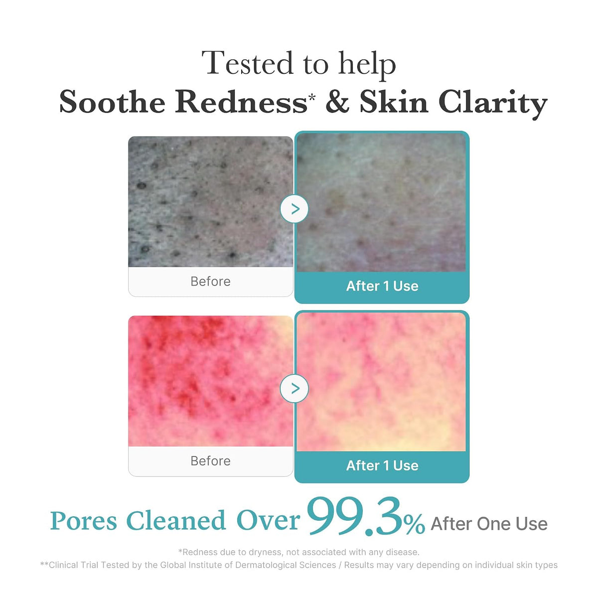 medicube Facial Cleanser Zero Pore Capsule Foam Cleanser