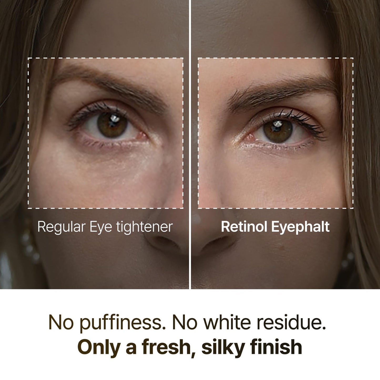 Dr.Melaxin Eyephalt Under Eye Cream for Dark Circles and Puffiness, Eye Cream for Bags Under Eyes with Bio-Spicule, EGF & Niacinamide, Depuffing Eye Bag Lifting Treatment, Korean Skin Care, 0.33 fl oz