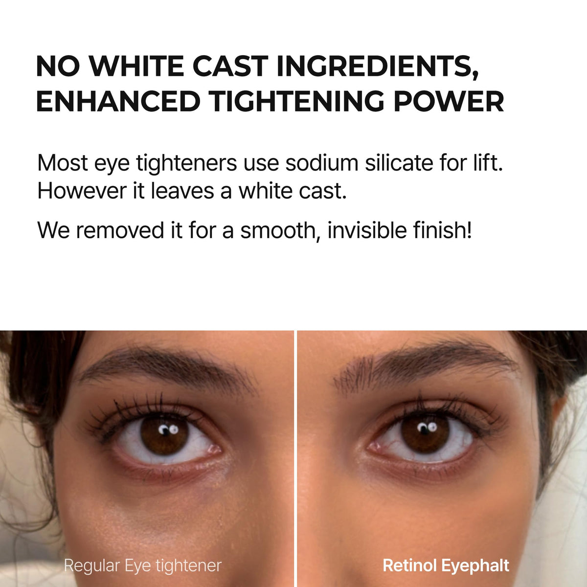 Dr.Melaxin Eyephalt Under Eye Cream for Dark Circles and Puffiness, Eye Cream for Bags Under Eyes with Bio-Spicule, EGF & Niacinamide, Depuffing Eye Bag Lifting Treatment, Korean Skin Care, 0.33 fl oz