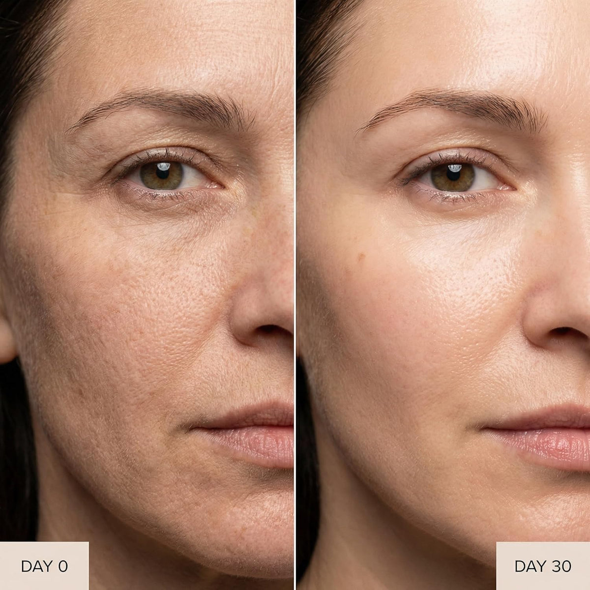 Micro Infusion System for Face & Neck-Micro Infusion Kit to Leave Skin Firmer & Smoother-0.25mm Facial Stamp with Collagen & Hyaluronic Acid Serum for At Home Glow and Anti-aging-3 Month Supply