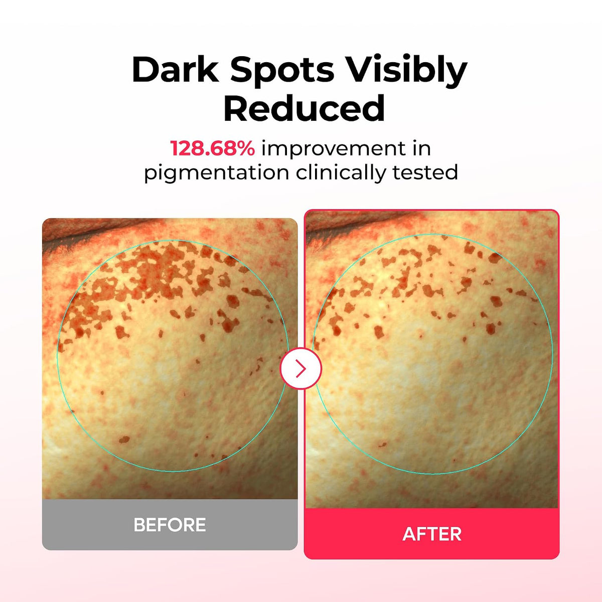 Dr.Melaxin TX Astaxanthin Melanin Recovery & Firming Hydrogel Mask (4 Sheets) – Dark Spot Correcting 2-Step Mask with Tranexamic Acid, Niacinamide, PDRN & Collagen for Elasticity
