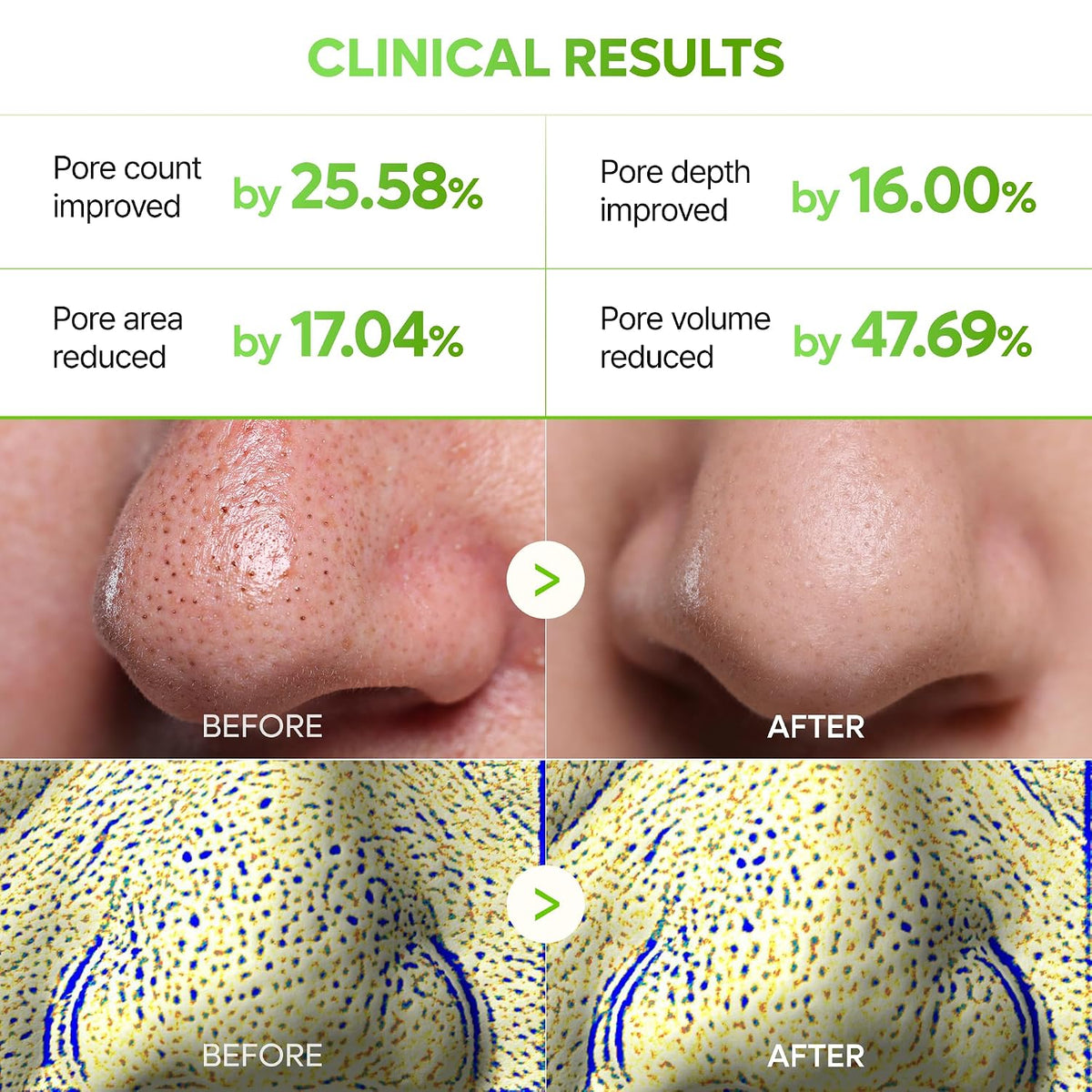 Dr.Melaxin CACTOX 3-STEP NOSE MASK PACK with AHA & PHA for Sebum Softening Pore Tightening Skin Repair 3-Step Nose Pore Pack