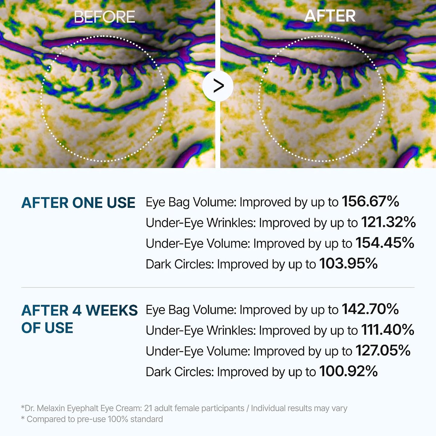 Dr.Melaxin Eyephalt Under Eye Cream for Dark Circles and Puffiness, Eye Cream for Bags Under Eyes with Bio-Spicule, EGF & Niacinamide, Depuffing Eye Bag Lifting Treatment, Korean Skin Care, 0.33 fl oz