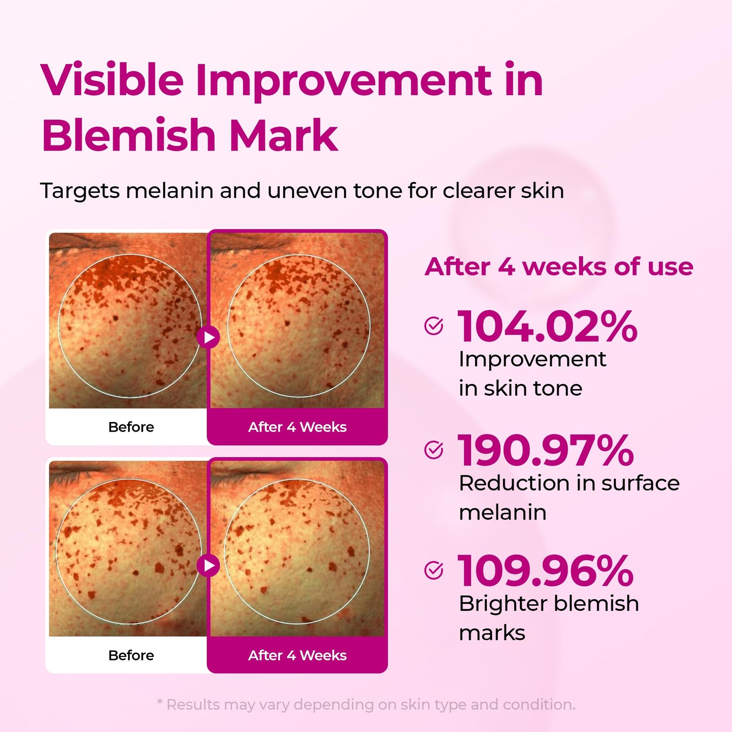Dr.Melaxin Cyano Pink Spicule Serum with Vitamin B12, Liquid Microneedle Facial Treatment for Enlarged Pores, Niacinamide for Texture Refining & Renewal, 1.01 fl.oz